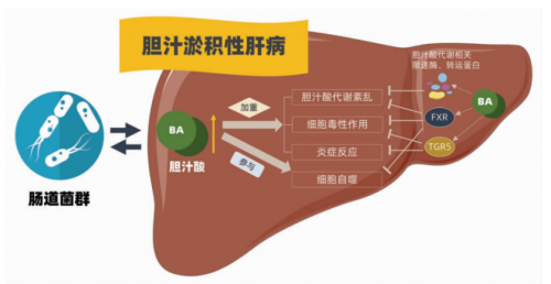 强肝胶囊调节肠道菌群改善非酒精性脂肪性肝病